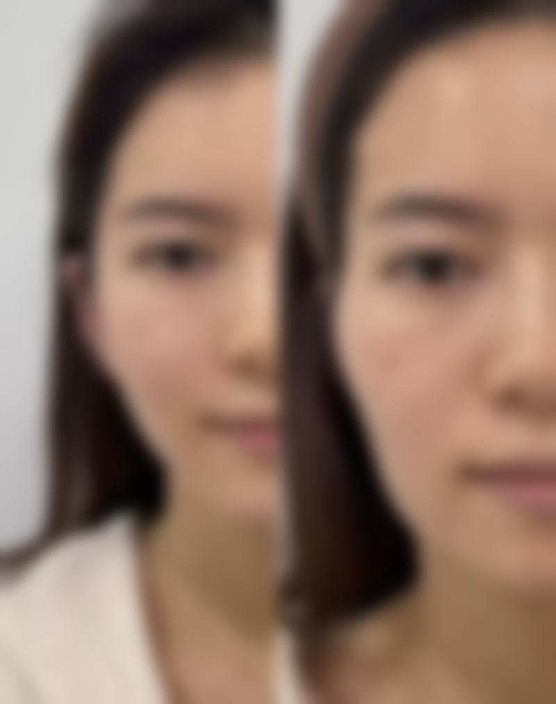 七、宁德东方秀丽华美整形医院真实的顾客评价如下：