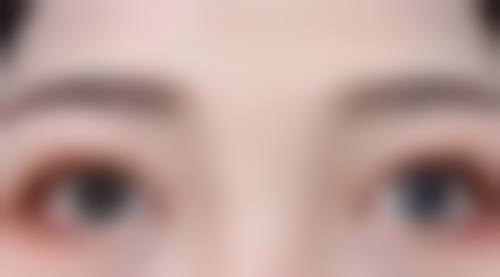 隆胸后能否给小孩喂奶？总结及安心建议