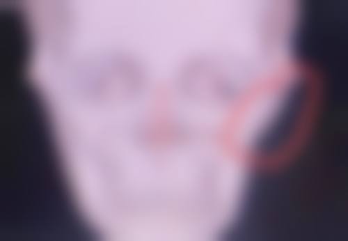 五、贵州省红十字会妇女儿童医院整形美容中 心实例