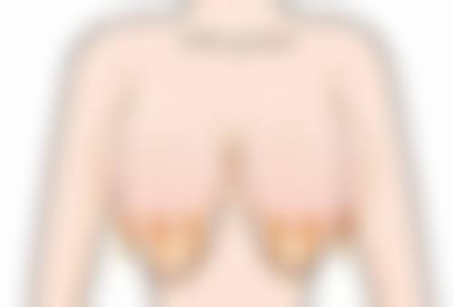 四、韩国纯真整形外科实例