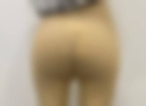 使用芦荟涂脸淡化疤痕的注意事项