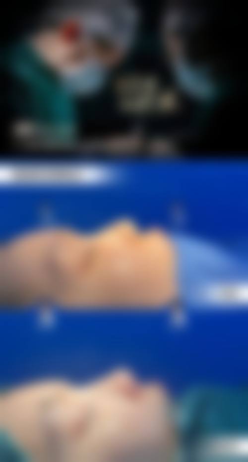 梁太鑫隆鼻实例