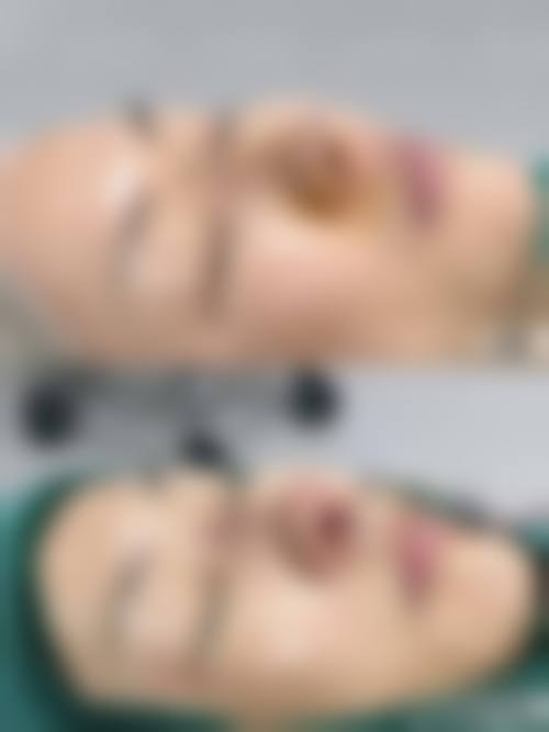 梁太鑫怎么预约？