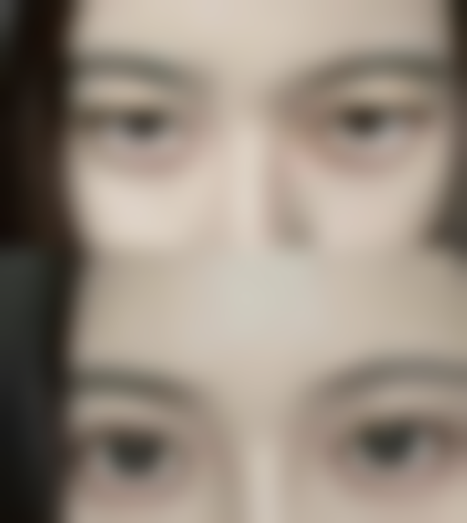 七、韩国纯真整形外科真实的顾客评价如下：