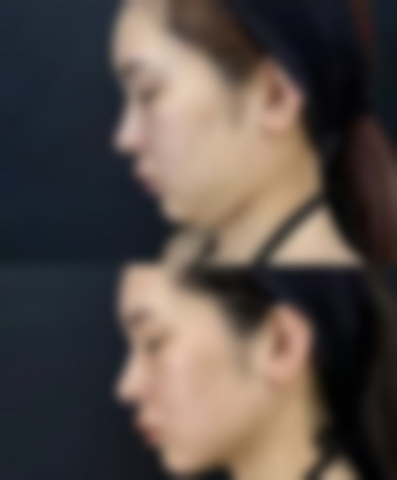 正确护理要点大公开，让帅楠眼袋贴成效翻倍