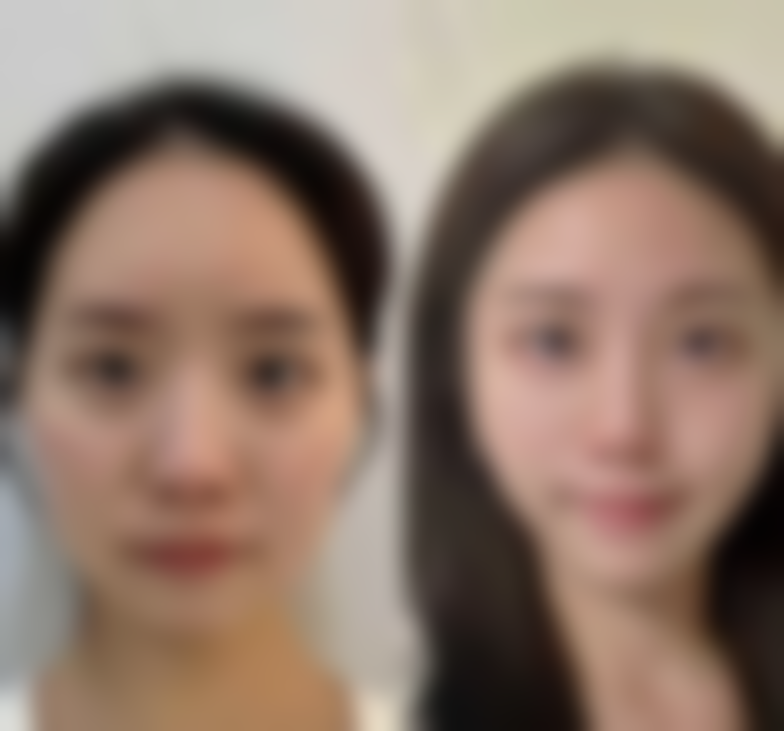 五、韩国纯真整形外科怎么预约：