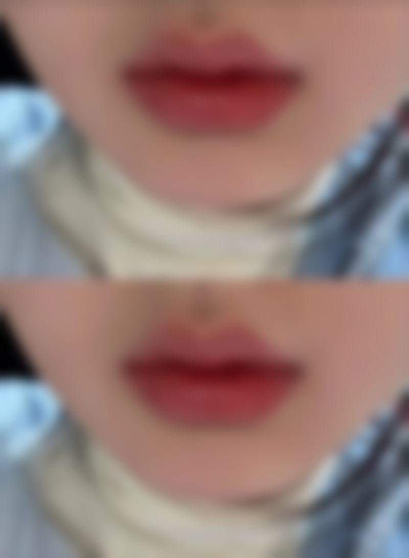 七、河科 大一附院整形美容科价格表：（仅供参考）