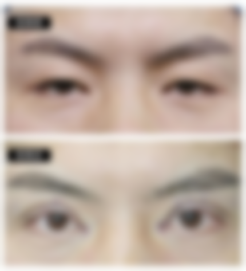 姜玉珀私人整形手术水平怎么样可靠吗？