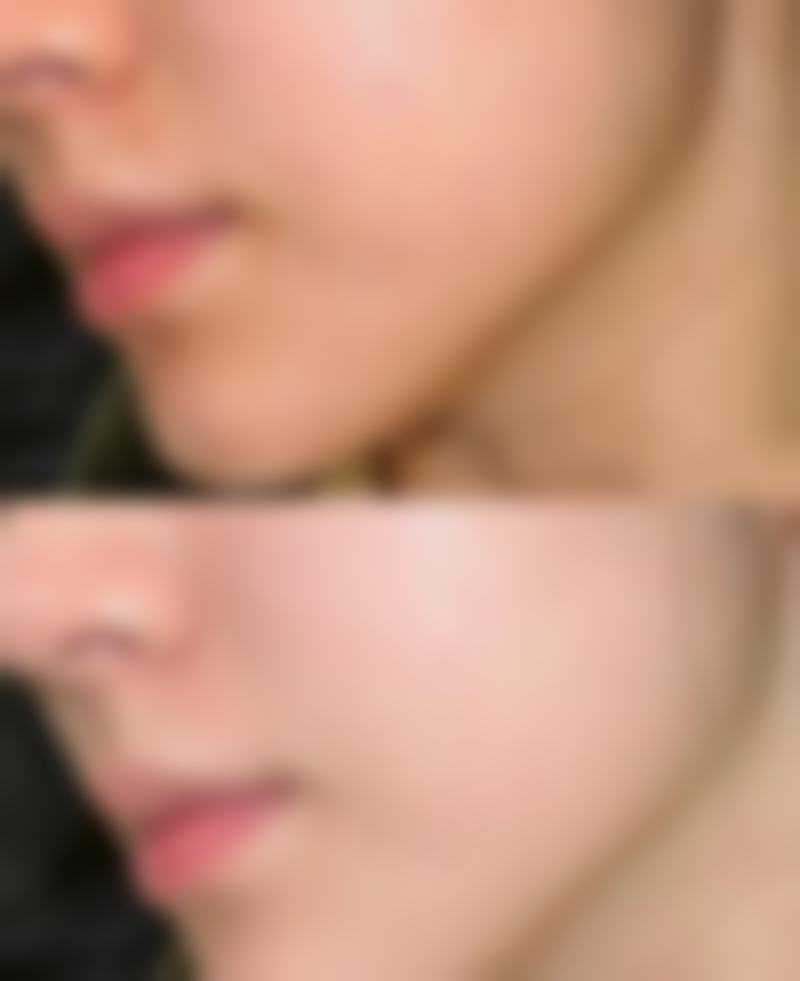 六、北京炫美码头医疗美容门诊部价格表：（仅供参考）