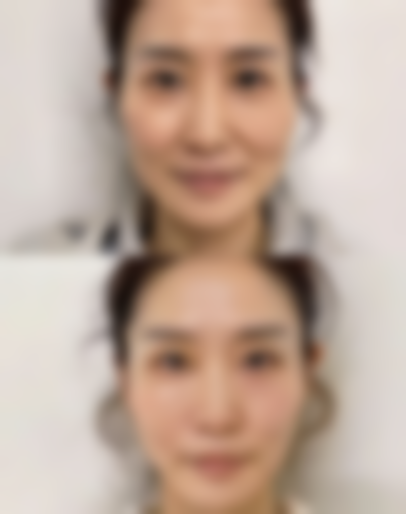 六、乌鲁木齐整形医院价格表：（仅供参考）