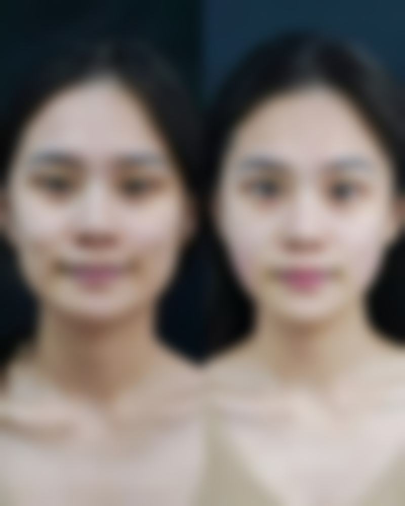 八、阆中阿蓝整形美容门诊部真实的顾客评价如下：