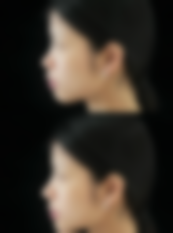 治疗方案联合定制的优势