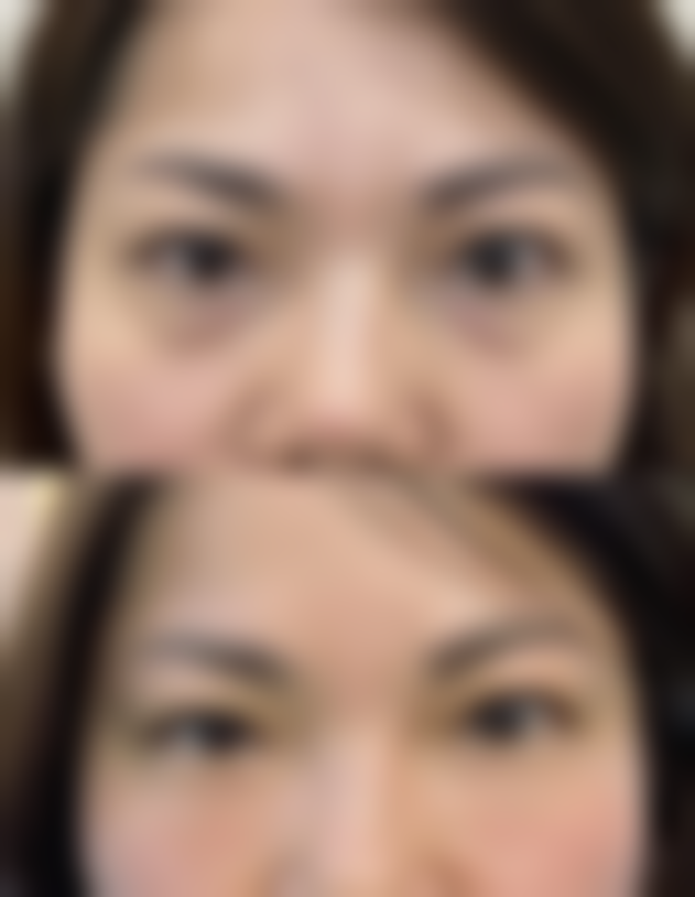 专精医院方案助力疤痕修复