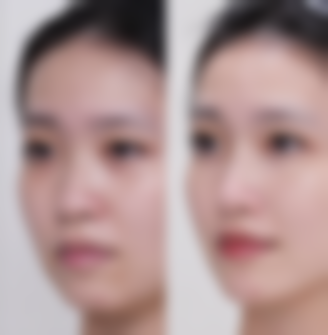 五、广州鸿业整形医院怎么预约：