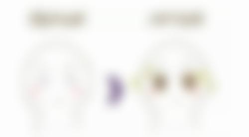 实例示范：正规医院助力下的耳软骨隆鼻取出后修复奇迹