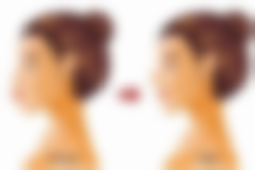 六、大连医 科 大学附属第一医院(整形美容外科)价格表：（仅供参考）