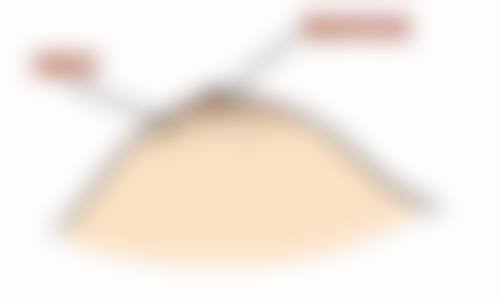 李戍波乳头乳晕缩小水平怎么样可靠吗？