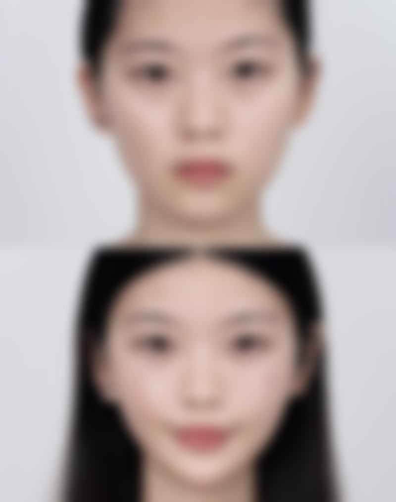 手术缝针疤痕消除攻略大揭秘！优质医院助力，专精保护成效