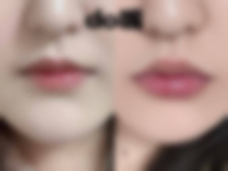 五、咸阳长城整形医院实例