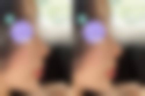 梁太鑫隆鼻实例