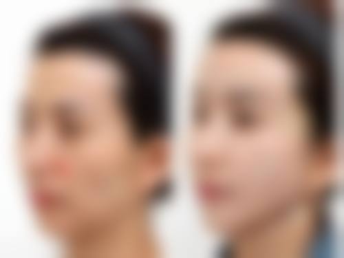 姜玉珀在哪家医院