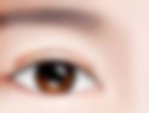 双眼皮术后眼皮松弛的处理办法