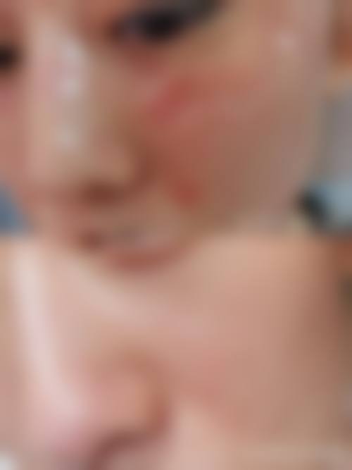 张东艳激光光美容水平怎么样可靠吗？