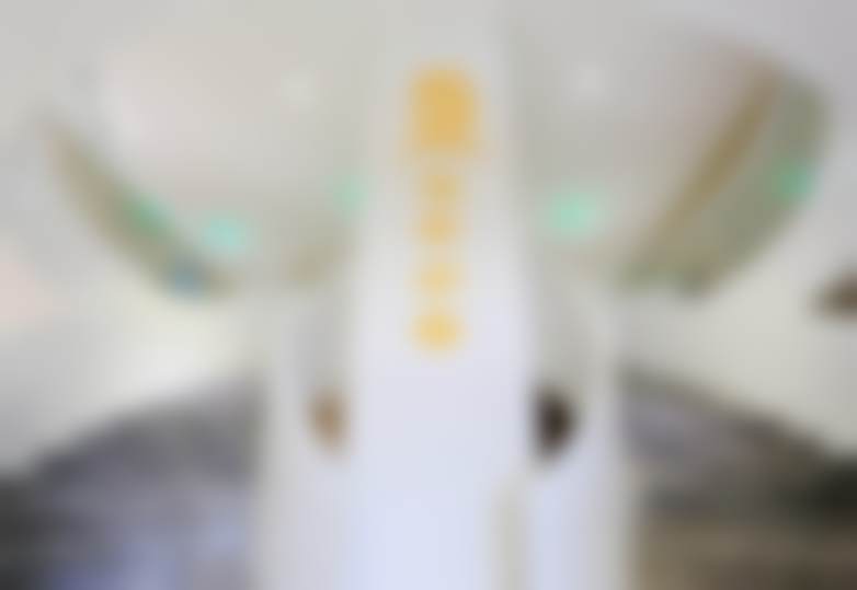 王玉婵埋线双眼皮实例