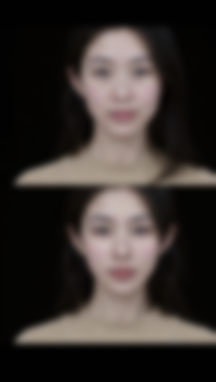 祛痣疤痕修复时间大揭秘：选择合适的医院助力修复