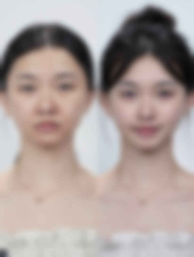 祛痣疤痕修复时间大揭秘：保持好心态耐心修复