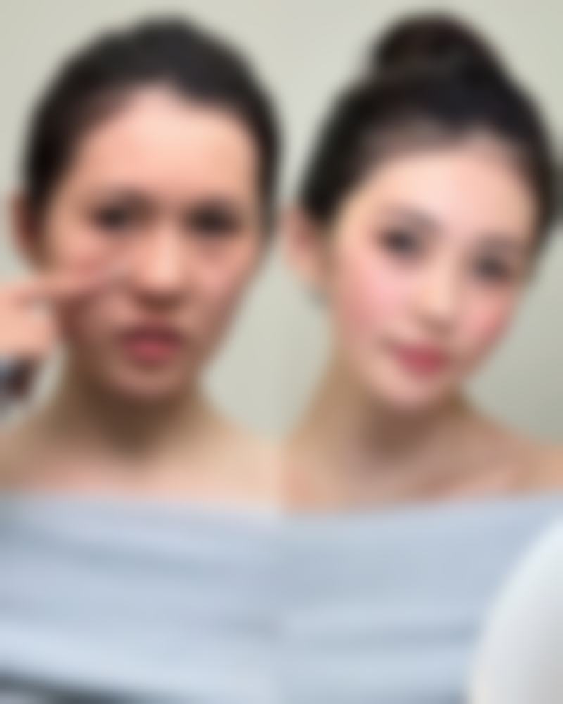 七、新疆乌鲁木齐瑞美华整形医院真实的顾客评价如下：