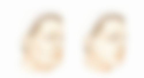 双眼皮埋线与切开咋挑？适用人群有差别