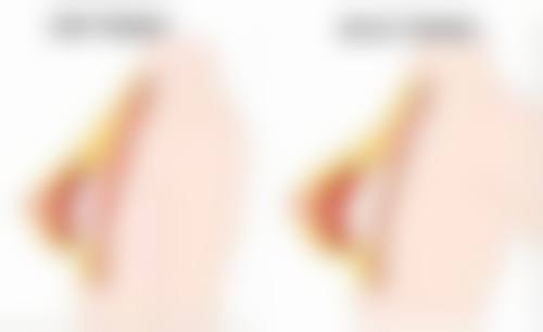 如何快速去除黑眼圈和眼袋？坚持才能见成效