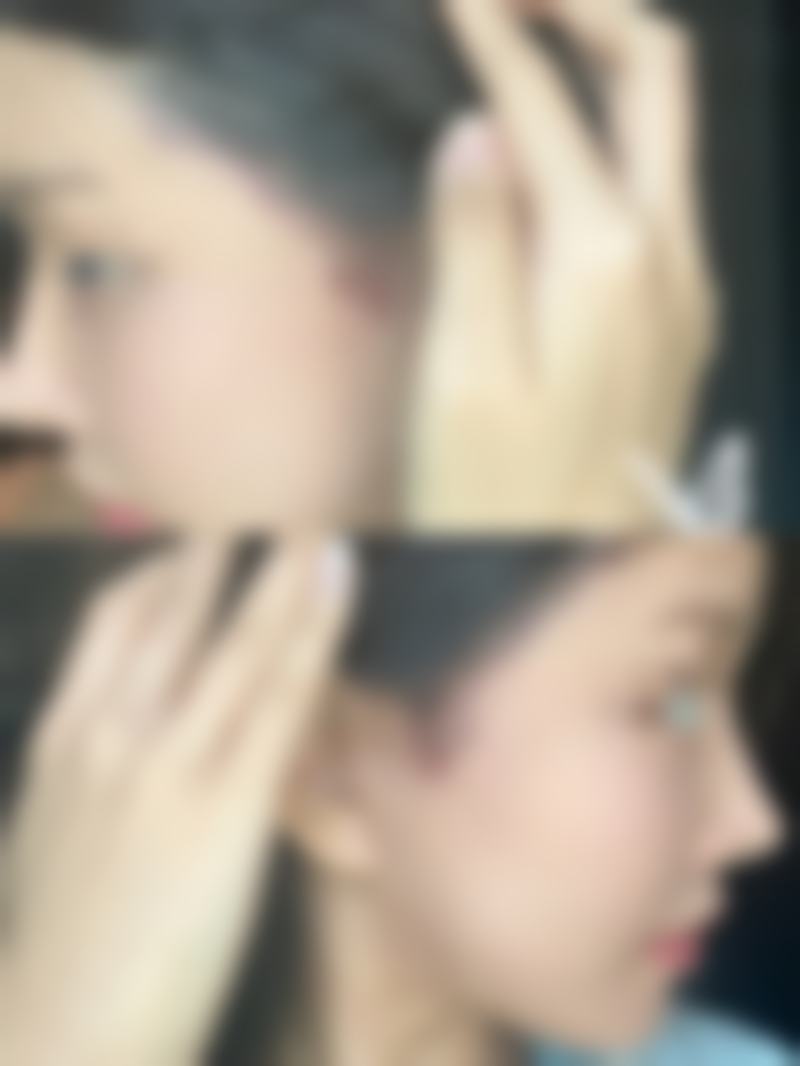 四、南京美约整形医疗美容诊所实例