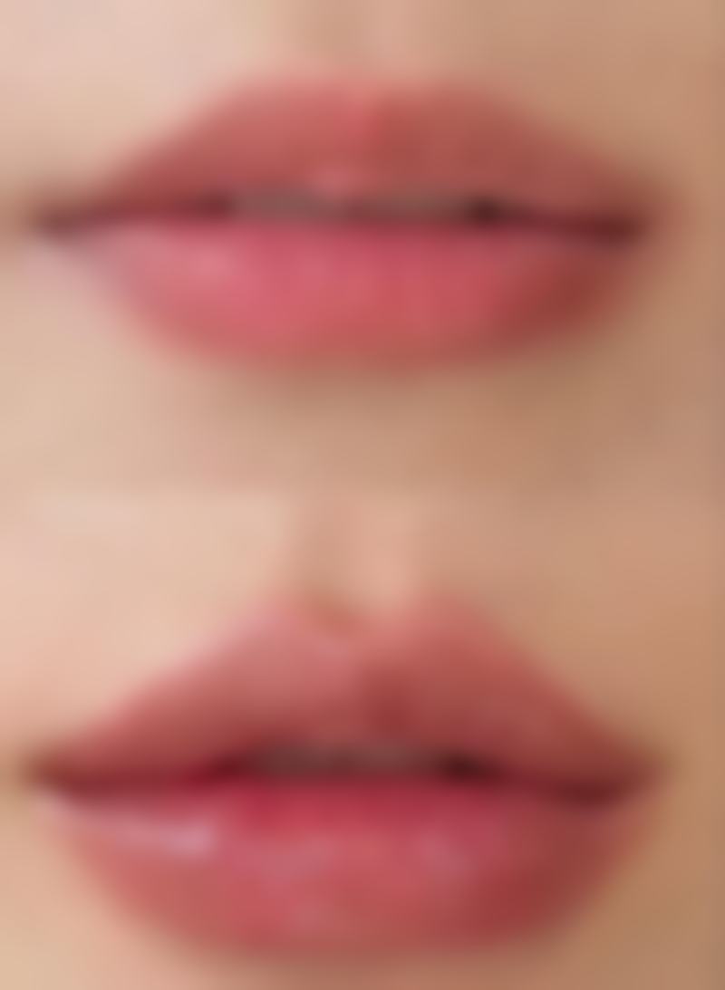 正规医院治疗疤痕增生的技术实力