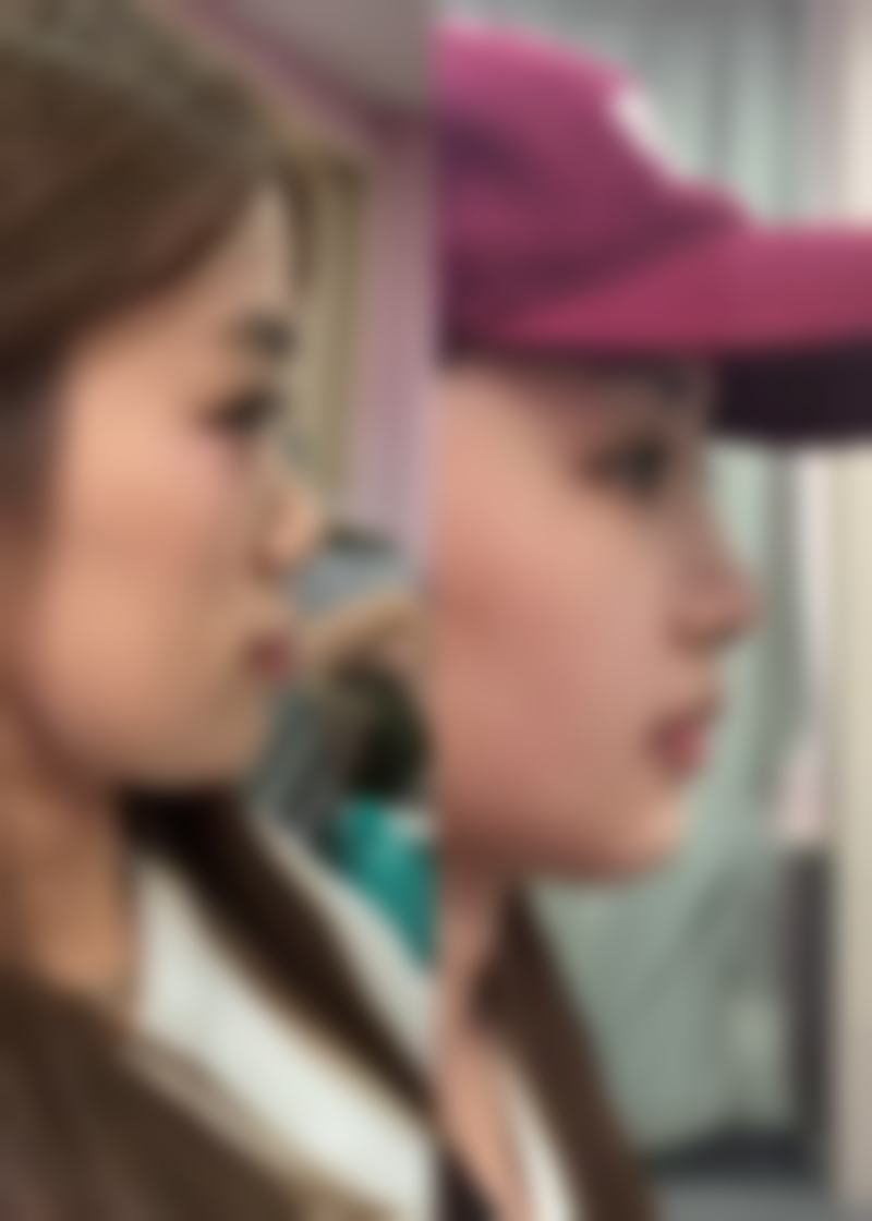 疤痕修复时间大揭秘：3个月到数年不等，正规医院专业助力加速恢复 