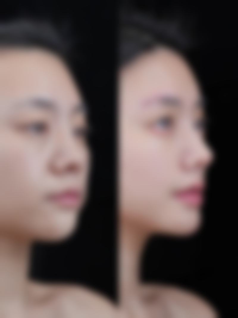 不同情况应对策略：个性化方案更贴心