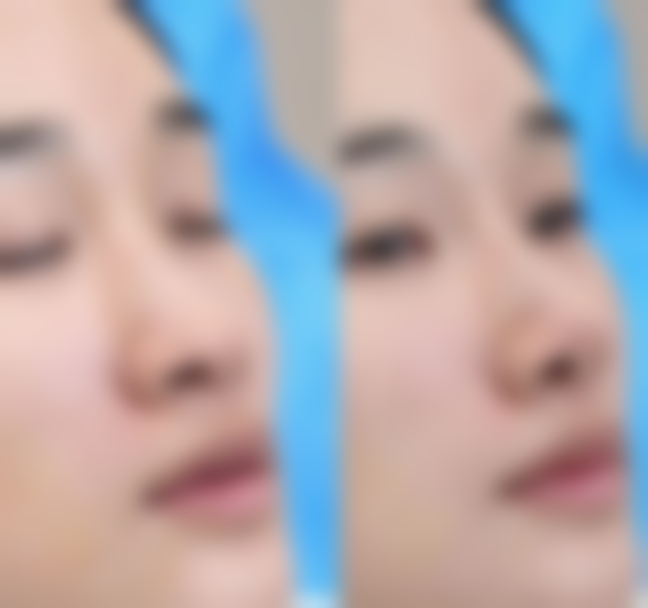 五、四川乐山经纬医学整形美容实例