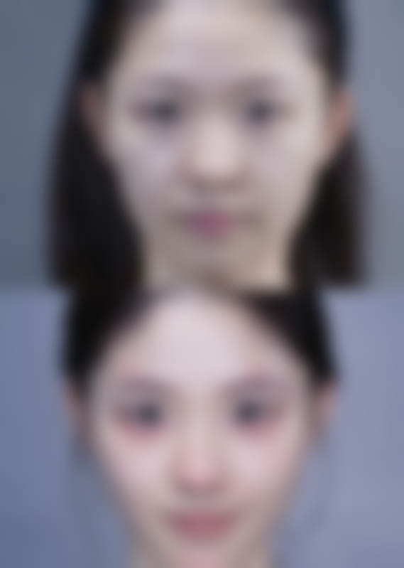 五、南京美约整形医疗美容诊所怎么预约：