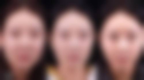 五、南昌韩美整形美容医院实例