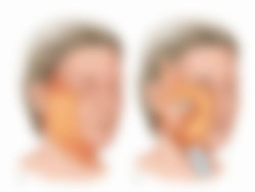 四、武汉民馨妇科医院医疗美容科开展的主要项目和特色项目：