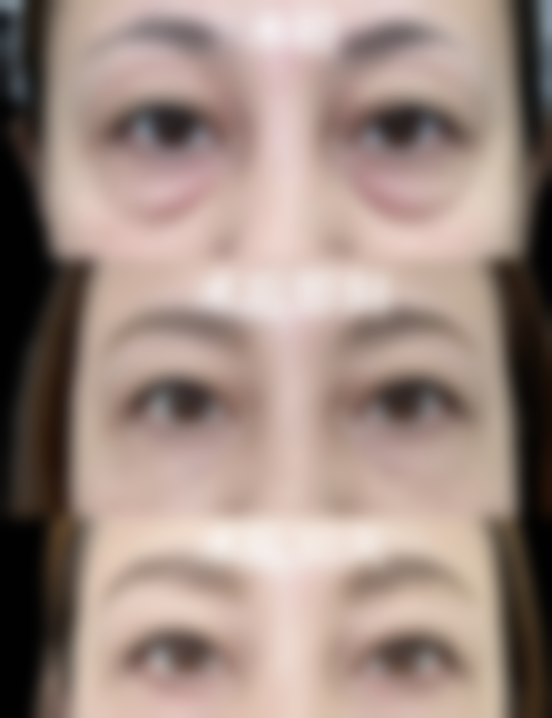 七、武汉民馨妇科医院医疗美容科价格表：（仅供参考）