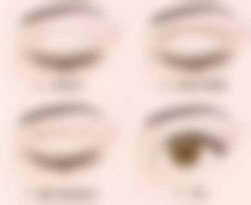 瘢痕处莫名长疙瘩是咋回事？选择专精医院的重要性