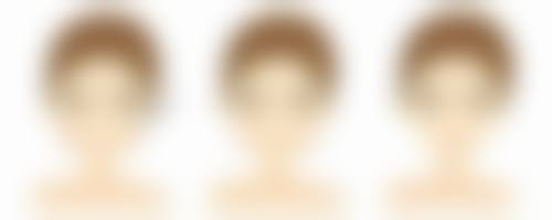 八、宁波鄞州宸沐整形医院真实的顾客评价如下：