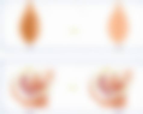 夏安香私密整形水平怎么样可靠吗？