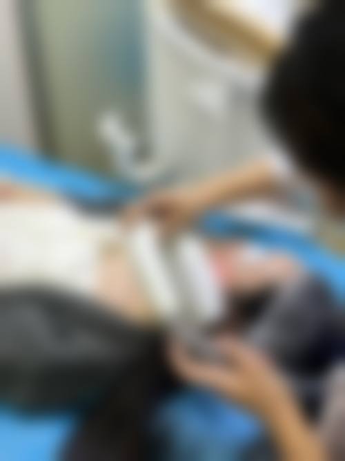 张儒庆光子嫩肤美白实例