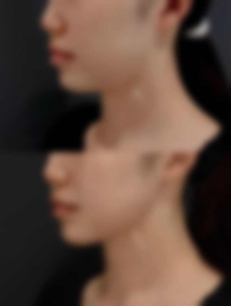 张科军眼部整形水平怎么样可靠吗？