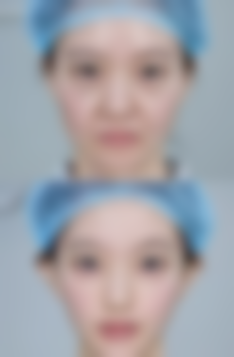 日常护理加把劲，助力疤痕快速消除