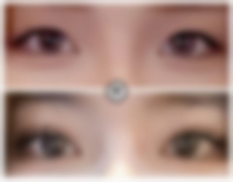 在家就能预防新眼袋生成？按摩手法不能少