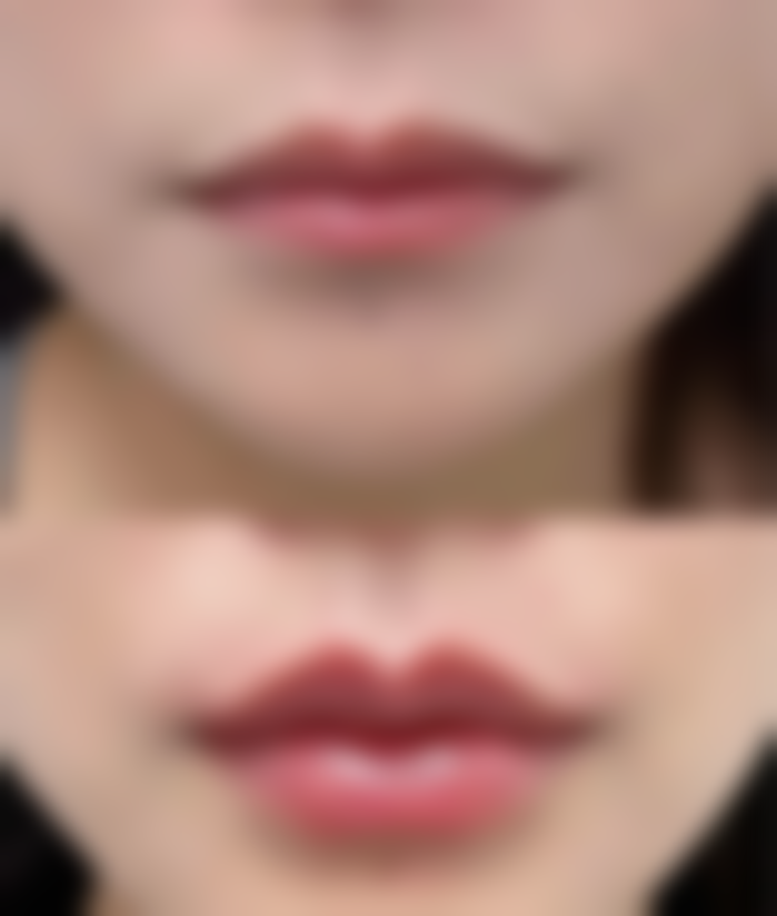 五、济南梅奥整形医院实例